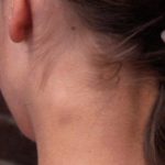 Origen emocional de la inflamación de los GANGLIOS LINFÁTICOS