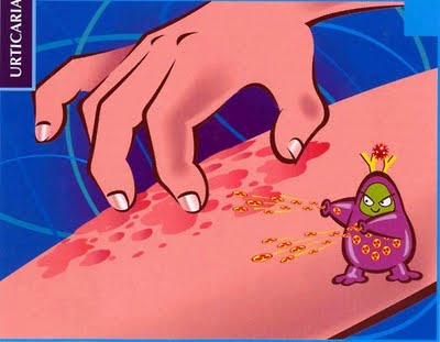 Lee más sobre el artículo Origen emocional de la URTICARIA