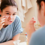 Causas emocionales que provocan ACNÉ