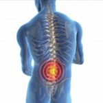 Origen emocional de la HERNIA DISCAL